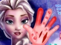 Gra Frozen. Hand surgery