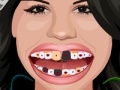 Gra Selena Gomez Perfect Teeth 