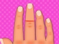 Gra Finger surgery